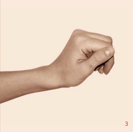 Šlachový transfer – rekonstrukční chirurgie horní končetiny