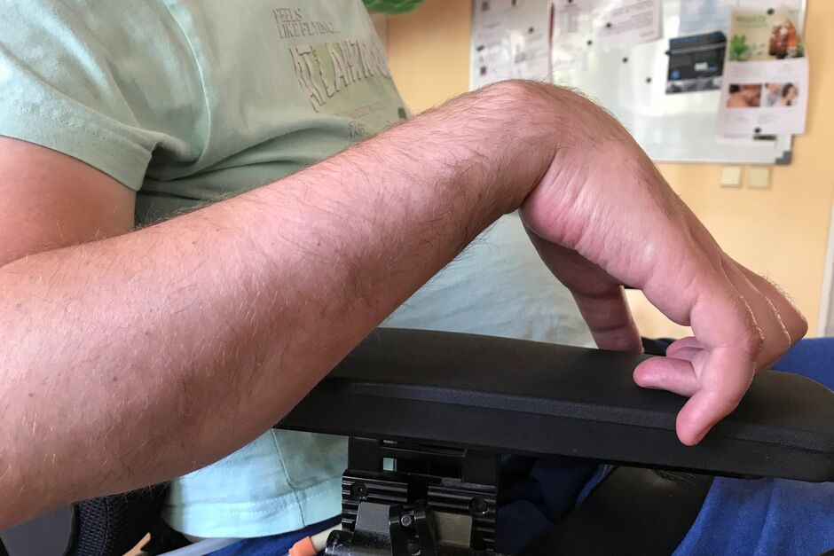 Úchop - To je oč u tetraplegiků běží